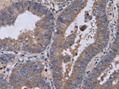 Anti-MKKS Antibody