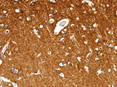 Anti-MAP4K1 Antibody