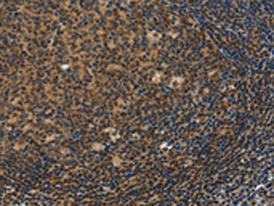 Anti-IRF9 / Interferon regulatory factor 9 Antibody
