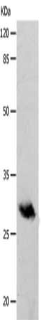 Anti-POMC Antibody