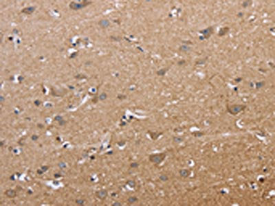 Anti-MAPRE3 / ECE1 Antibody