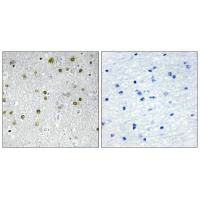 Anti-NRIP2 Antibody