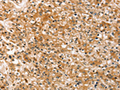 Anti-SLC40A1 Antibody