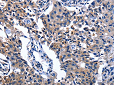Anti-NAT8 Antibody