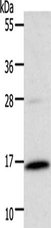 Anti-CSF2 Antibody