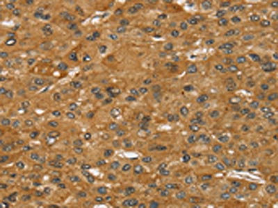 Anti-SPTAN1 Antibody