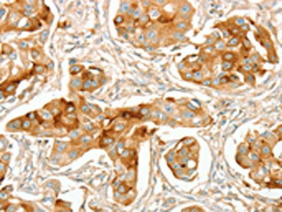 Anti-ACE / Angiotensin I converting enzyme Antibody