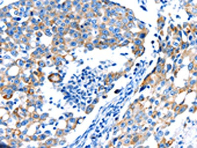 Anti-POMC Antibody