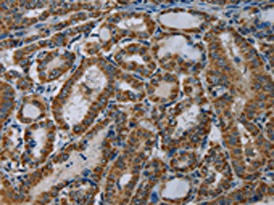 Anti-NDUFA5 Antibody