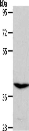 Anti-S1PR4 Antibody