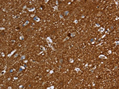 Anti-SNCG Antibody