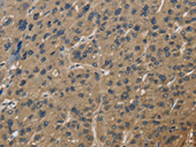 Anti-CORO1C Antibody