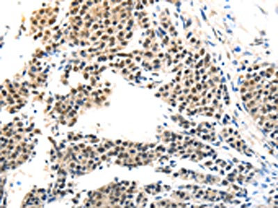 Anti-MAGEA6 Antibody