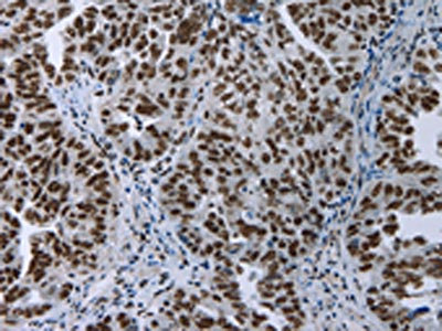 Anti-ELN / Elastin Antibody