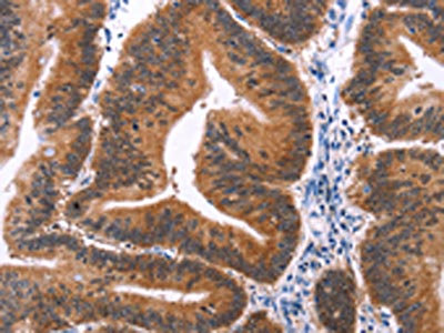 Anti-MAPK13 Antibody
