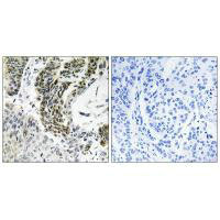Anti-RREB1 Antibody