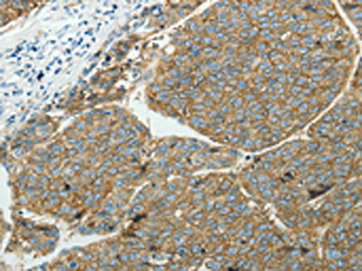 Anti-SLC16A1 Antibody