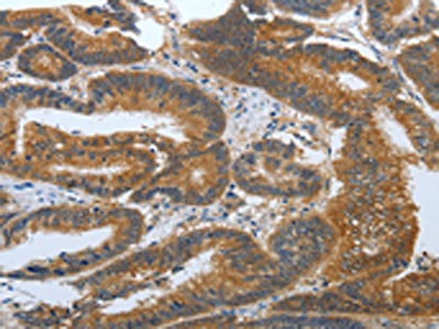 Anti-PSCA Antibody