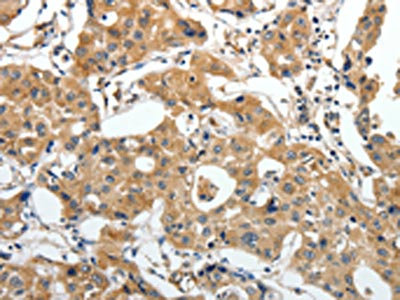 Anti-STEAP4 / Six-transmembrane epithelial antigen of prostate 4 Antibody