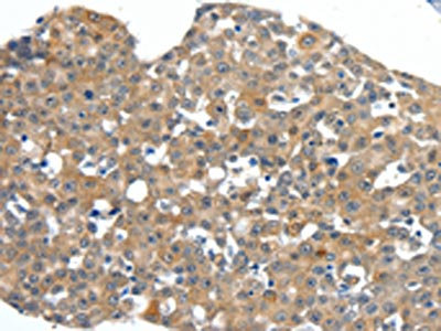 Anti-SCN11A / NaV1.9 Antibody