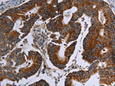 Anti-MDFIC Antibody