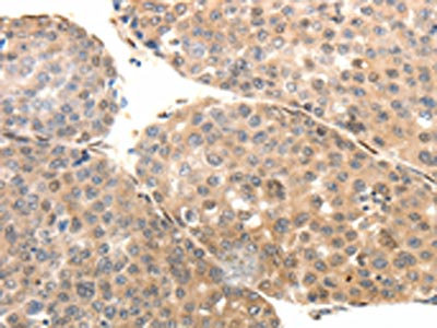 Anti-SYT7 / Synaptotagmin 7 Antibody