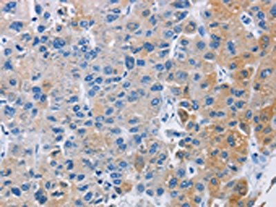 Anti-CARD14 Antibody