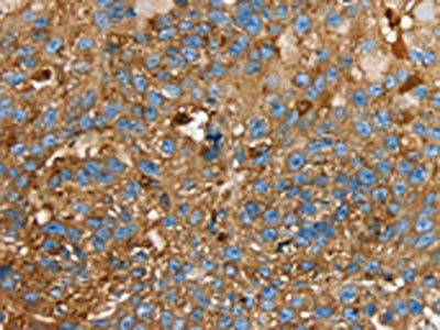 Anti-LGALS3BP Antibody