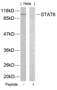Anti-STAT6 (Ab-645) Antibody