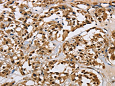 Anti-HNRNPL / Heterogeneous nuclear ribonucleoprotein L Antibody