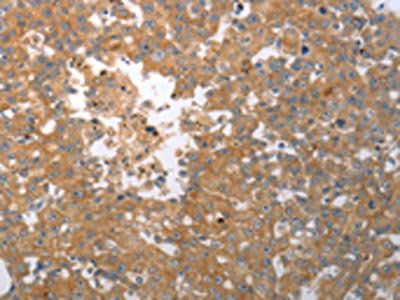 Anti-SHH Antibody