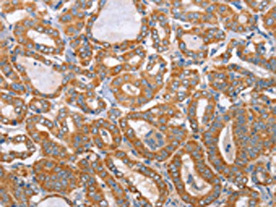 Anti-MTMR7 Antibody
