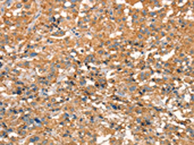 Anti-ARFGEF2 Antibody