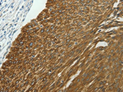Anti-NDRG2 Antibody