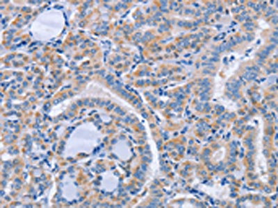 Anti-CD36 Antibody