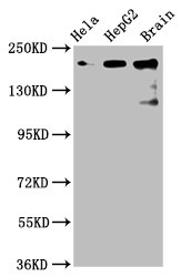 Anti-CKAP5 Antibody