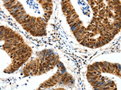 Anti-SP1 Antibody