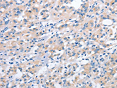 Anti-NCAPD2 Antibody