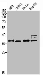 Anti-PMEPA1 Antibody