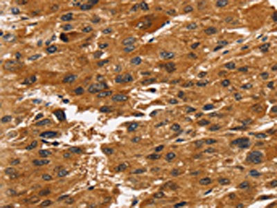 Anti-TACC2 / Transforming acidic coiled-coil-containing protein 2 Antibody