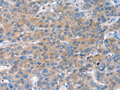 Anti-CHAC1 Antibody
