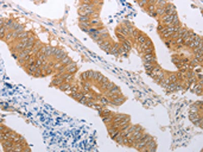 Anti-PDK4 Antibody