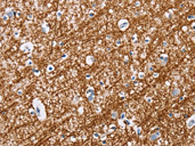 Anti-MAG Antibody