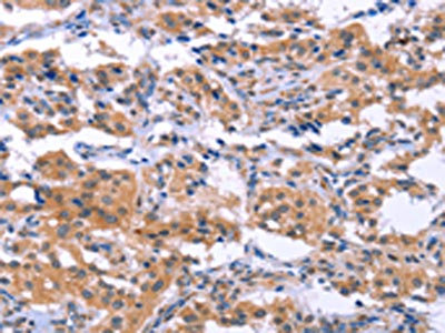 Anti-ESPL1 / Separin Antibody