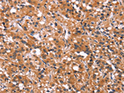 Anti-MAPK11 Antibody