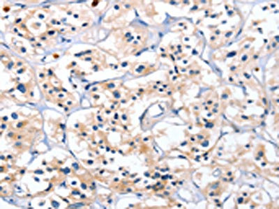 Anti-CATSPER1 Antibody