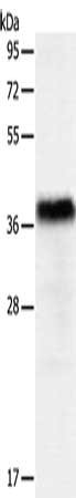 Anti-PGBD2 Antibody