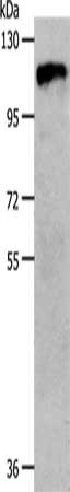 Anti-CSF1R Antibody