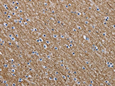 Anti-NEFM Antibody