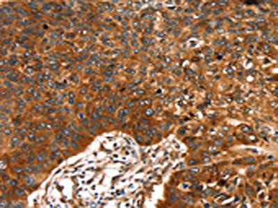Anti-RUNX2 Antibody